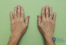 Photo of Липофилинг: восстановление объемов