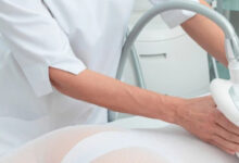 Photo of Криолиполиз: снижение объемов тела