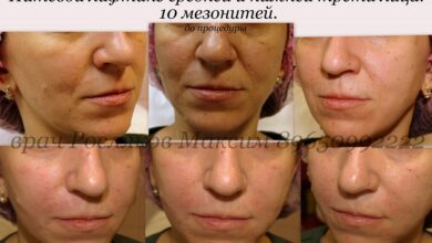 Photo of Мезонити: инъекции молодости